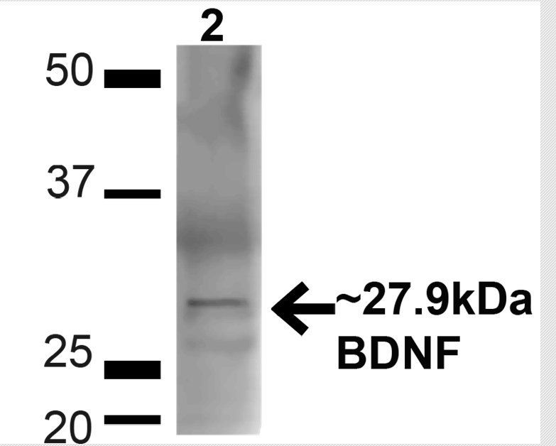BDNF Antibody