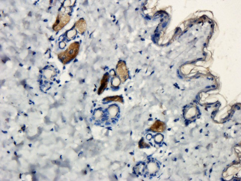 BDNF antibody