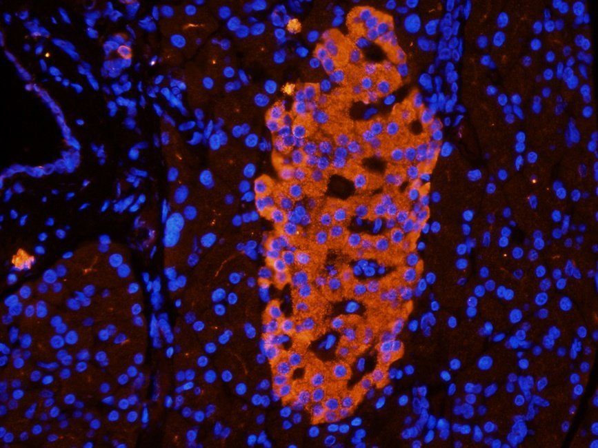 Beclin 1 antibody