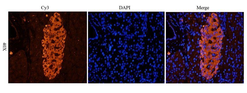 Beclin 1 antibody