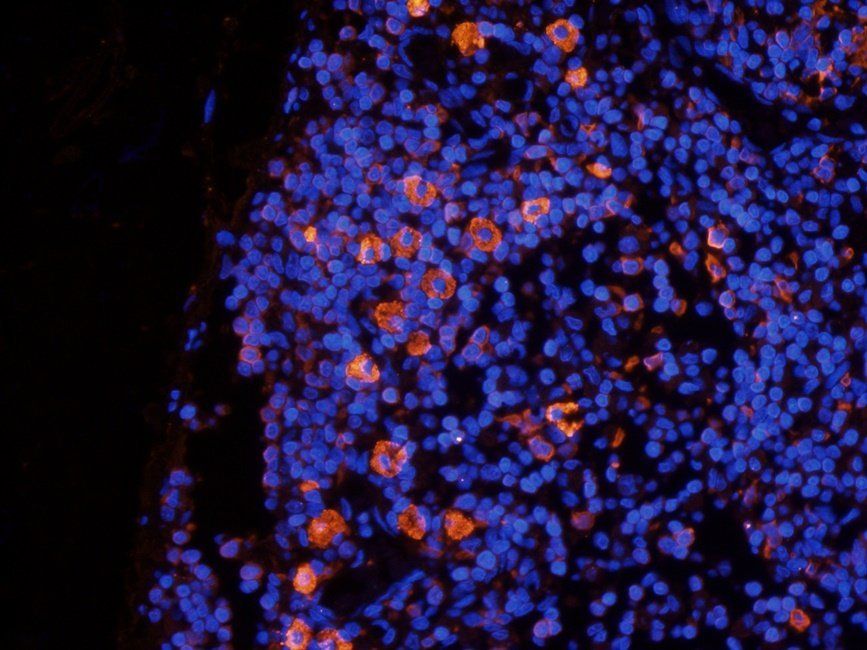 Beclin 1 antibody