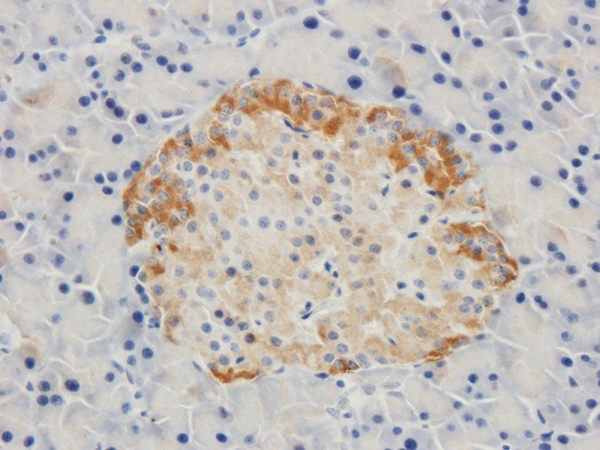 Beclin 1 antibody