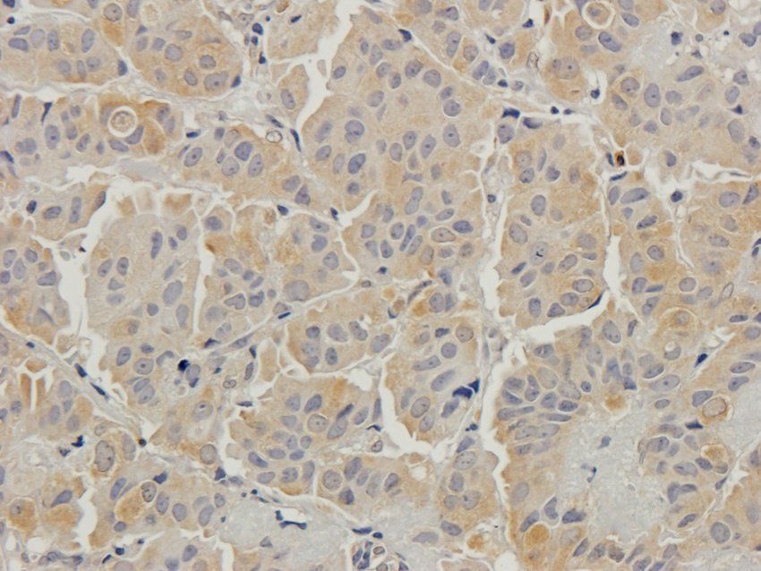 Beclin 1 antibody