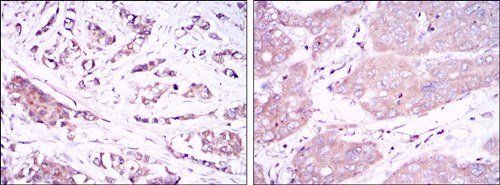 BECN1 Antibody