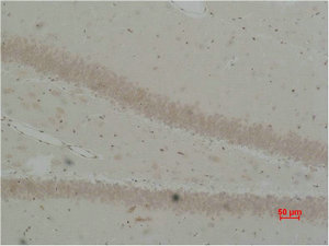 BEST2 Antibody