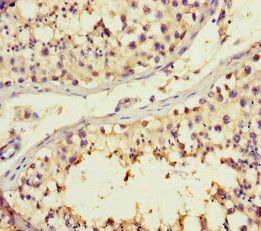 B4GALT3 Antibody