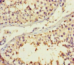 Beta-1, 4-galactosyltransferase 3 antibody