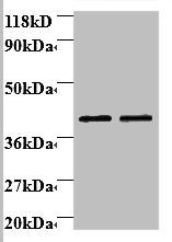 Beta-1, 4-galactosyltransferase 3 antibody