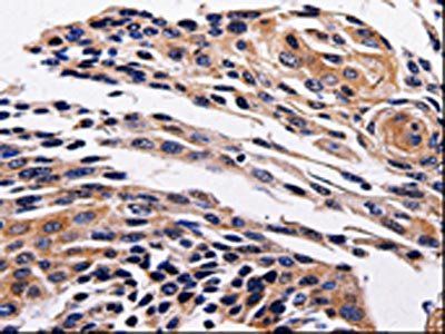 ADRB1 Antibody
