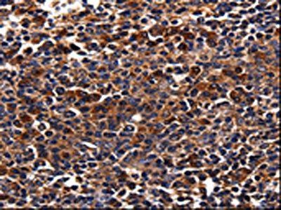 ADRB1 Antibody