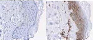 Beta-2-Microglobulin antibody (Peroxidase)