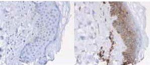 Beta-2-Microglobulin antibody (Peroxidase)