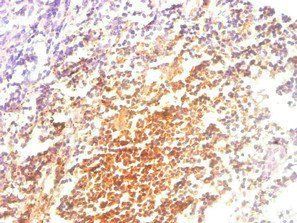 B2M Antibody