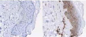 Beta-2-Microglobulin antibody