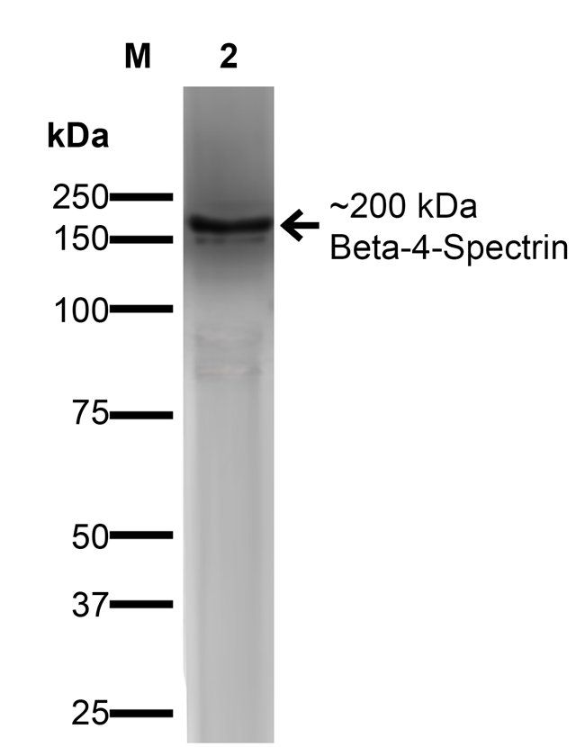 beta 4 Spectrin Antibody