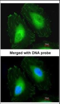 beta A4 Crystallin Rabbit Polyclonal Antibody