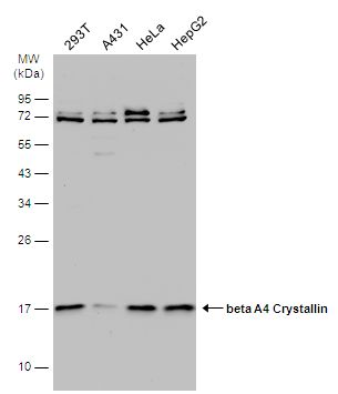 beta A4 Crystallin Rabbit Polyclonal Antibody