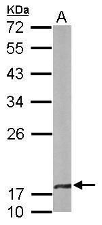 beta A4 Crystallin Rabbit Polyclonal Antibody