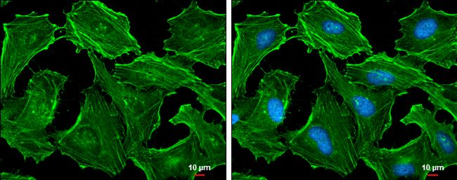 actin beta Antibody