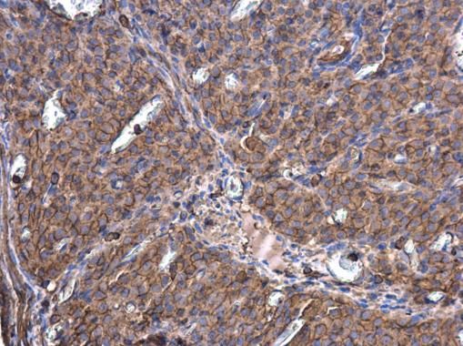 actin beta Antibody