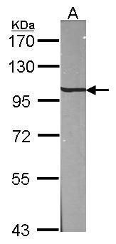beta-Adaptin Rabbit Polyclonal Antibody