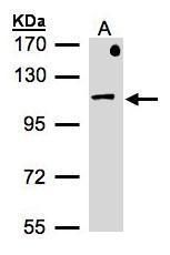 beta-Adaptin Rabbit Polyclonal Antibody