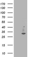 beta Catenin Antibody