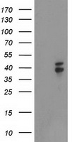 beta Catenin Antibody