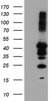 beta Catenin Antibody