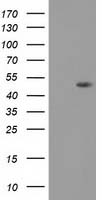 beta Catenin Antibody
