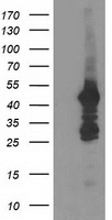 CTNNB1 Antibody