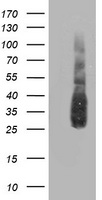 beta Catenin Antibody