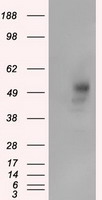 beta Catenin Antibody