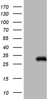CTNNB1 Antibody