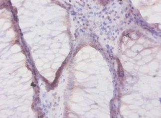 DEFB1 Antibody