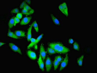 Beta-enolase antibody