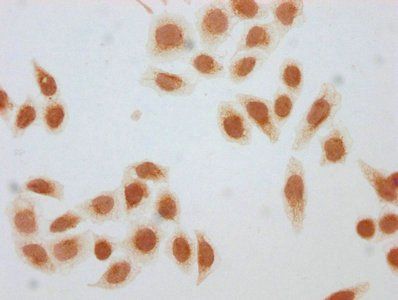 HIST1H1D Antibody
