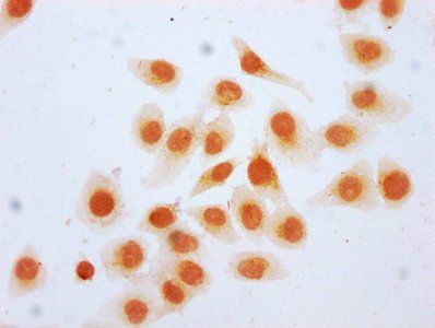 HIST1H2BC Antibody