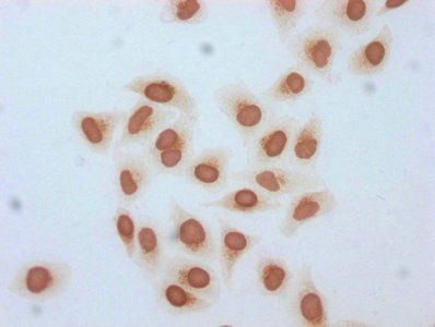 β-hydroxybutyryl-HIST1H3A (K18) Antibody