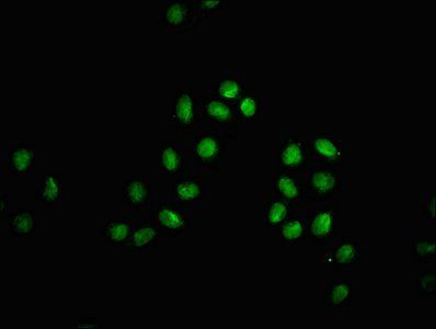 β-hydroxybutyryl-HIST1H3A (K18) Antibody