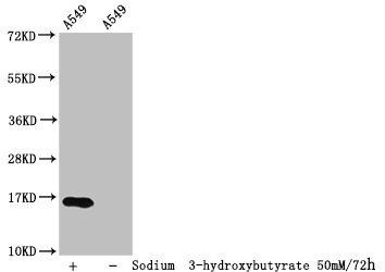 β-hydroxybutyryl-HIST1H3A (K23) Antibody