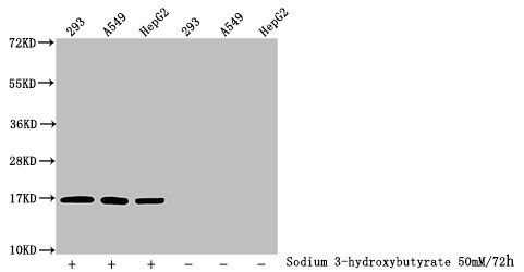 β-hydroxybutyryl-HIST1H3A (K27) Antibody