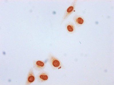 β-hydroxybutyryl-HIST1H3A (K4) Antibody