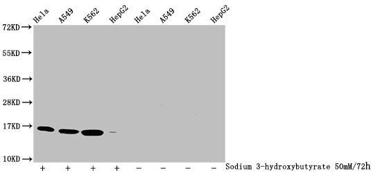 β-hydroxybutyryl-HIST1H3A (K4) Antibody