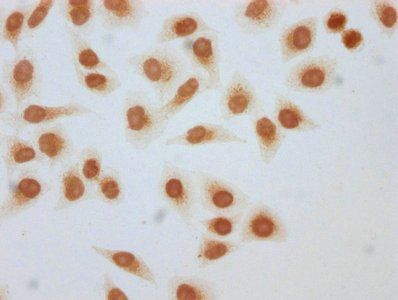 β-hydroxybutyryl-HIST1H3A (K56) Antibody