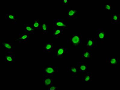 β-hydroxybutyryl-HIST1H3A (K56) Antibody