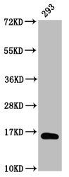 β-hydroxybutyryl-HIST1H3A (K9) Antibody