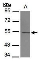 tubulin beta 4A class IVa Antibody