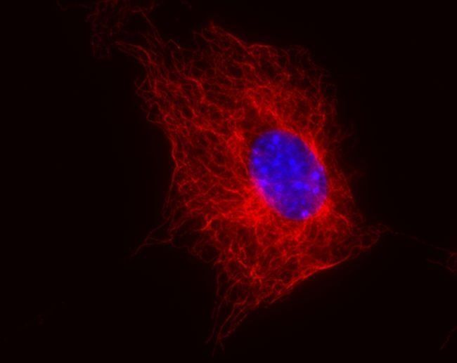 beta tubulin antibody