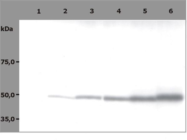 beta tubulin antibody